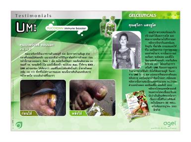 AGEL UMI ผลิตภัณฑ์เสริมอาหาร ดูแลสุขภาพ ปัญหาสุขภาพ เบาหวาน ภูิมิต้านทาน มะเร็ง