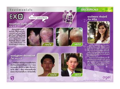 AGEL EXO ลดสิวอักเสบ ภูมิแพ้ ปวดประจำเดือน ไมเกรน