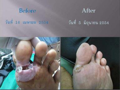 ผลลัพธ์จากลูกค้าที่ใช้ผลิตภัณฑ์จิง